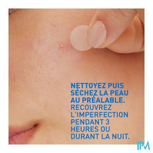 Afbeelding in Gallery-weergave laden, Cerave A/onzuiverheden Patches 22