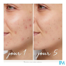 Load image into Gallery viewer, La Rosee Zuiv.serum T/onzuiv.zn&fruitzuren.bio30ml