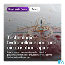 Afbeelding in Gallery-weergave laden, Compeed Patch Koortsblaasjes 15 Met Applicator