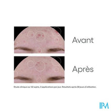 Afbeelding in Gallery-weergave laden, Aderma Biology Ac Global Verzorg. Onzuiverh. 40ml