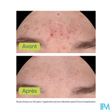 Afbeelding in Gallery-weergave laden, Aderma Biology Ac Night Peel Serum A/onzuiv. 30ml