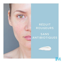 Afbeelding in Gallery-weergave laden, Dermalex A/roodheid Creme 30g