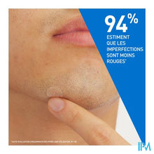 Afbeelding in Gallery-weergave laden, Cerave A/onzuiverheden Patches 22