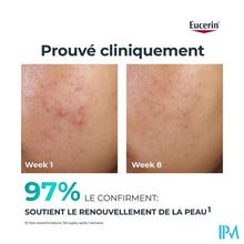 Load image into Gallery viewer, Eucerin Dermopure Clinic.peel.10 Nachtverzorg.40ml