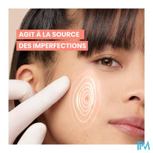 Load image into Gallery viewer, Avene Cleanance Comedomed+ 30ml