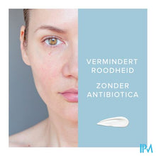Afbeelding in Gallery-weergave laden, Dermalex A/roodheid Creme 30g