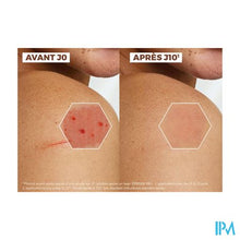 Afbeelding in Gallery-weergave laden, Aderma Epitheliale Creme A/vlekken 100ml