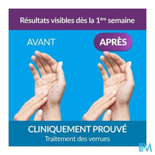 Afbeelding in Gallery-weergave laden, Excilor Gelbehandeling Wratten 4ml