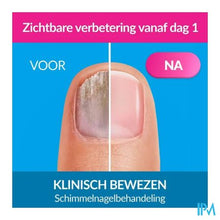 Bild in der Galerieansicht laden, Excilor Forte Fungal Nails 30ml
