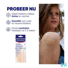 Afbeelding in Gallery-weergave laden, Hansaplast Littekenvervager Xl
