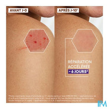 Load image into Gallery viewer, Aderma Epitheliale Creme A/vlekken 100ml
