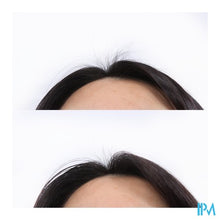 Load image into Gallery viewer, Klorane Capil. Serum Kinine 100ml
