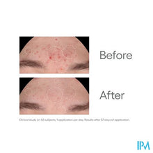 Afbeelding in Gallery-weergave laden, Aderma Biology Ac Night Peel Serum A/onzuiv. 30ml
