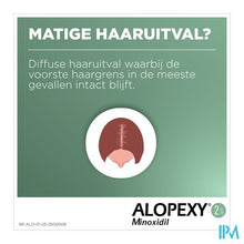 Load image into Gallery viewer, Alopexy 2 % Liquid Fl Pipet/spray 3x60ml
