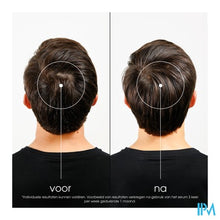 Load image into Gallery viewer, Klorane Capil. Serum Kinine 100ml
