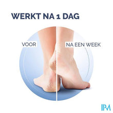 Load image into Gallery viewer, Scholl Voetscheuren Behandeling K+ 60ml
