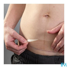 Afbeelding in Gallery-weergave laden, Lansinoh Hydrogel Keizersnede Patch 1

