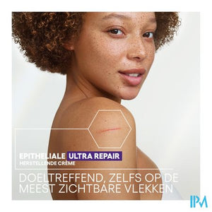 Aderma Epitheliale Creme A/vlekken 40ml