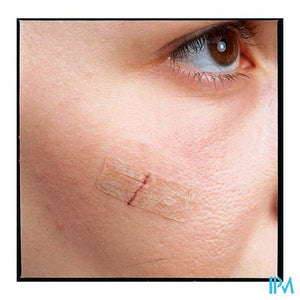 Nexcare 3m Steri-strip Wondsluit. Beige 6mmx75mm 6