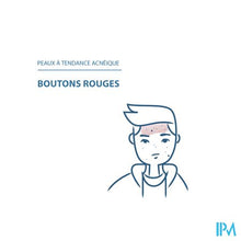 Afbeelding in Gallery-weergave laden, Ducray Keracnyl Pp+ Creme 30ml
