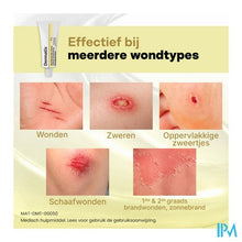 Load image into Gallery viewer, Dermatix Wondhelende Creme 32g
