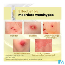 Load image into Gallery viewer, Dermatix Wondhelende Spray 35ml
