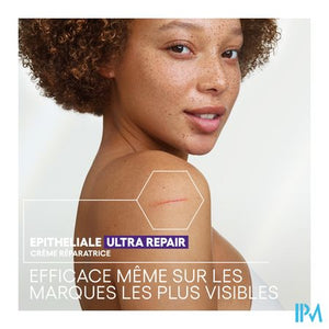Aderma Epitheliale Creme A/vlekken 40ml