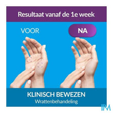 Load image into Gallery viewer, Excilor Gelbehandeling Wratten 4ml
