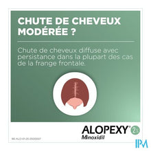 Charger l&#39;image dans la galerie, Alopexy 2 % Liquid Fl Pipet/spray 1x60ml
