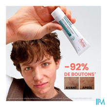 Load image into Gallery viewer, Avene Cleanance Comedomed Peeling 40ml
