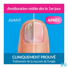 Load image into Gallery viewer, Excilor Forte Schimmelnagels 30ml
