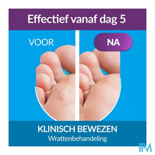 Afbeelding in Gallery-weergave laden, Excilor Wrattenbehandeling Duo Power 10ml+1,5g
